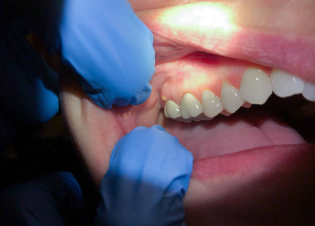 Best Walk-In Emergency Dental Services in Midway South, TX
